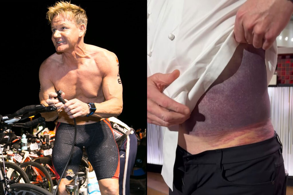 Gordon_Ramsay_Bike_Accident